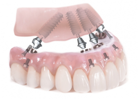 Dentures &raquo; Dr.Steven W. Haywood