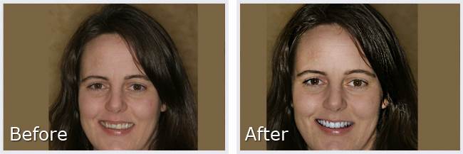 Before After