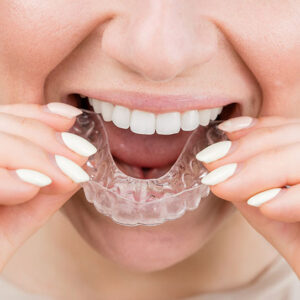 dentist near me Invisalign