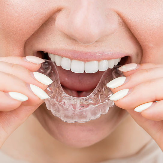 dentist near me Invisalign