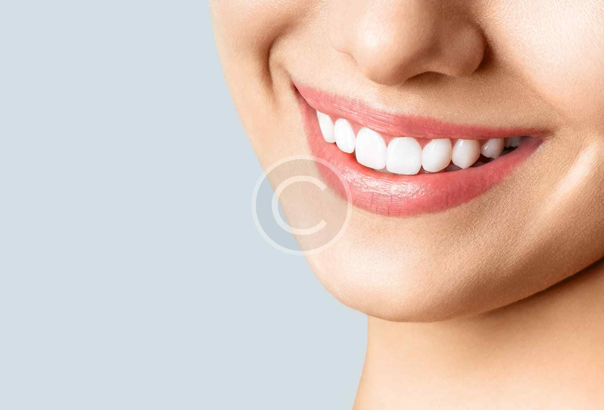 Teeth whitening